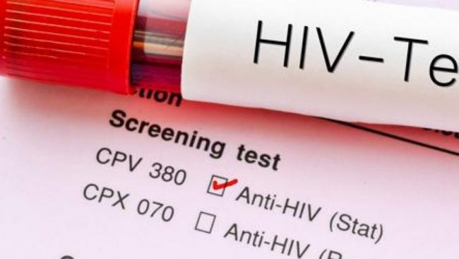 La Liguria tra le regioni con il maggior numero di infezioni da HIV