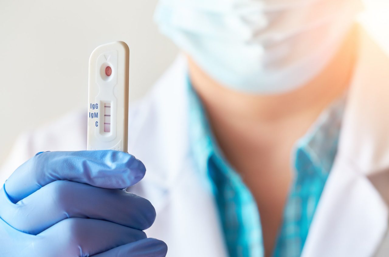 Da lunedì basterà il tampone antigenico per accertare positività