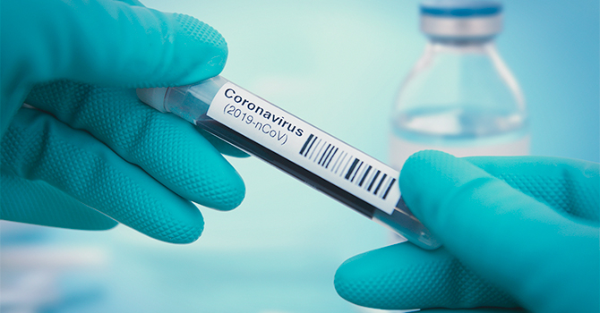 Coronavirus in Liguria: oggi  6183 positivi (42 in meno rispetto a ieri)