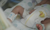 Equipe multidisciplinare del Gaslini esegue doppio intervento salvavita su neonato affetto da gravissima malformazione