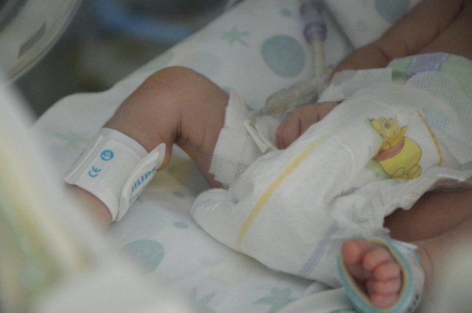 Equipe multidisciplinare del Gaslini esegue doppio intervento salvavita su neonato affetto da gravissima malformazione