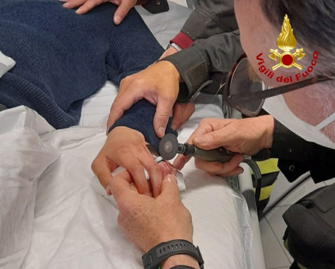 Dito gonfio, l’anello non esce: intervengono i vigili del fuoco