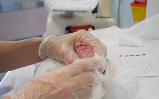 Celiachia, parte lo screening neonatale  in tutta la Liguria grazie al Gaslini Diffuso