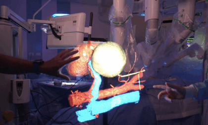 RAISE e la ricostruzione 3D degli organi: un progetto di Spoke 2 con l’ospedale San Martino di Genova