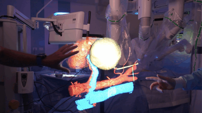 RAISE e la ricostruzione 3D degli organi: un progetto di Spoke 2 con l’ospedale San Martino di Genova